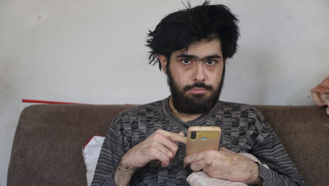 3 yıldır evden dışarı adım atmadı: “Banyo da yapmak istemiyorum, elimde olsa tuvalete gitmem” 3 yıldır evden dışarı adım atmadı: “Banyo da yapmak istemiyorum, elimde olsa tuvalete gitmem”