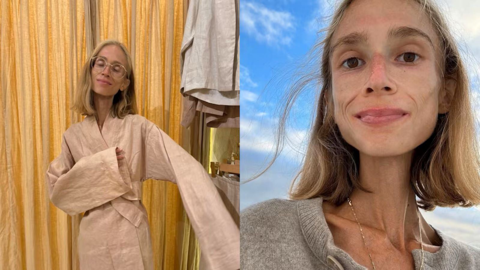 27 yaşındaki influencer’ın sonu oldu, 22 kiloya düşüp öldü 27 yaşındaki influencer’ın sonu oldu, 22 kiloya düşüp öldü