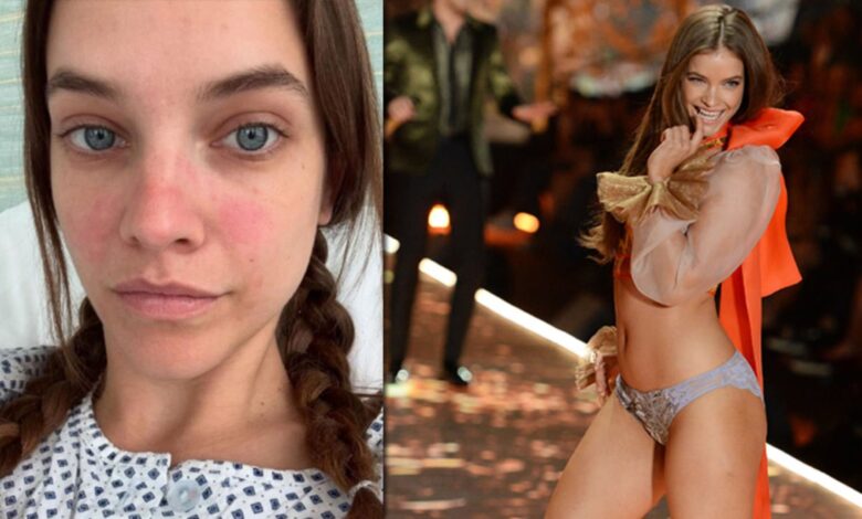 Barbara Palvin, endometriozis nedeniyle ameliyat oldu Barbara Palvin, endometriozis nedeniyle ameliyat oldu