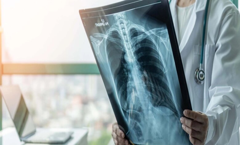 Prof. Dr. Şener’den süperenfeksiyon uyarısı Prof. Dr. Şener’den süperenfeksiyon uyarısı