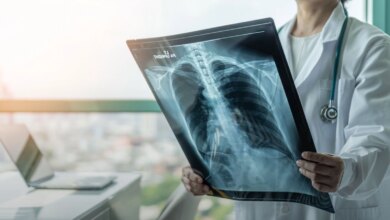 Kronik Tromboembolik Pulmoner Hipertansiyon Hakkında Kronik Tromboembolik Pulmoner Hipertansiyon Hakkında